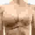 Ciplastic plastic surgery results
