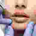 Ciplastic plastic surgery results