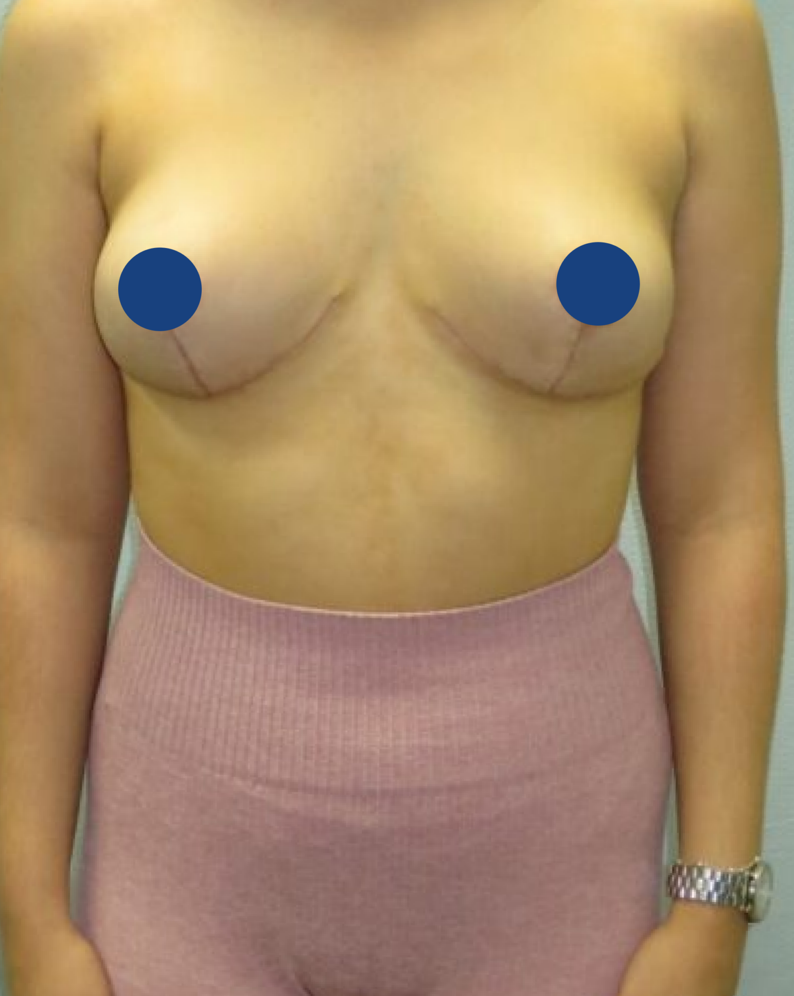 Ciplastic plastic surgery results