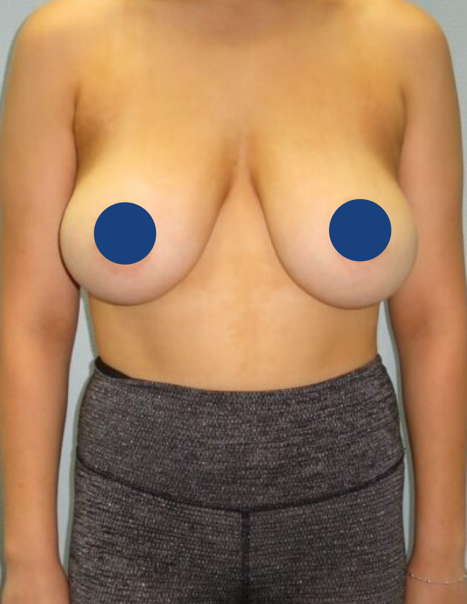 Ciplastic plastic surgery results