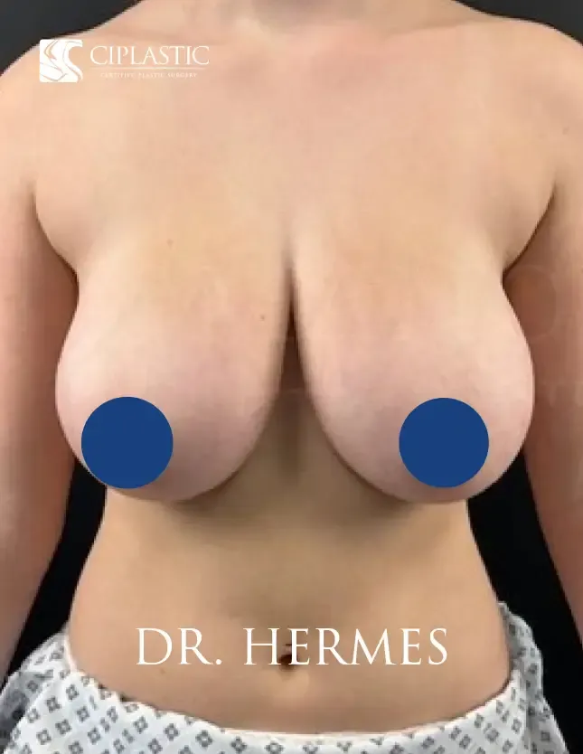 Ciplastic plastic surgery results
