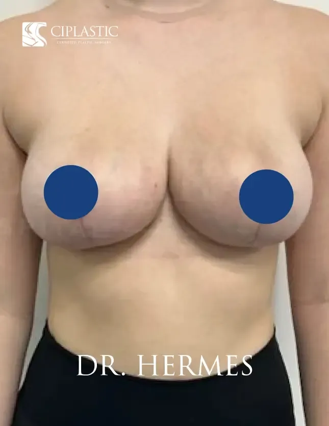 Ciplastic plastic surgery results