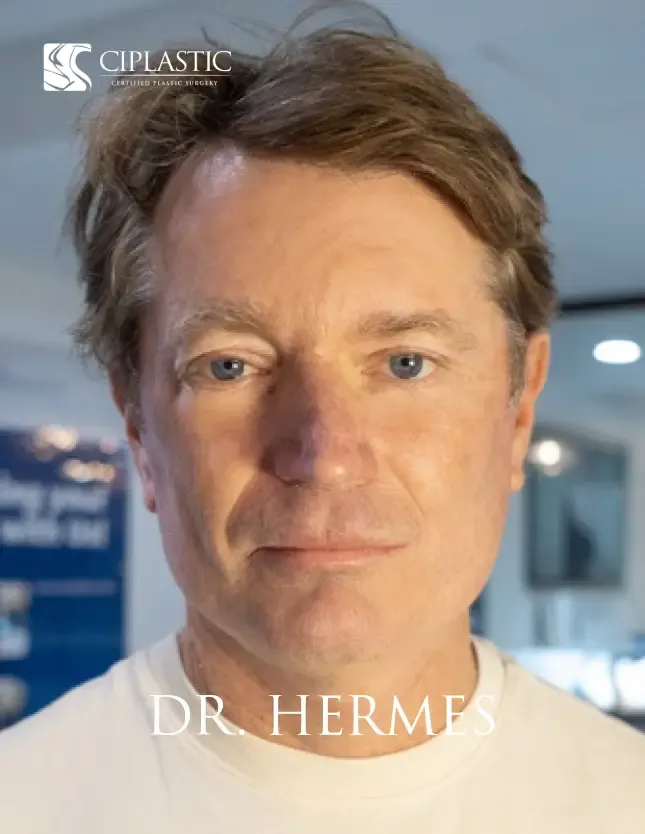 Ciplastic plastic surgery results