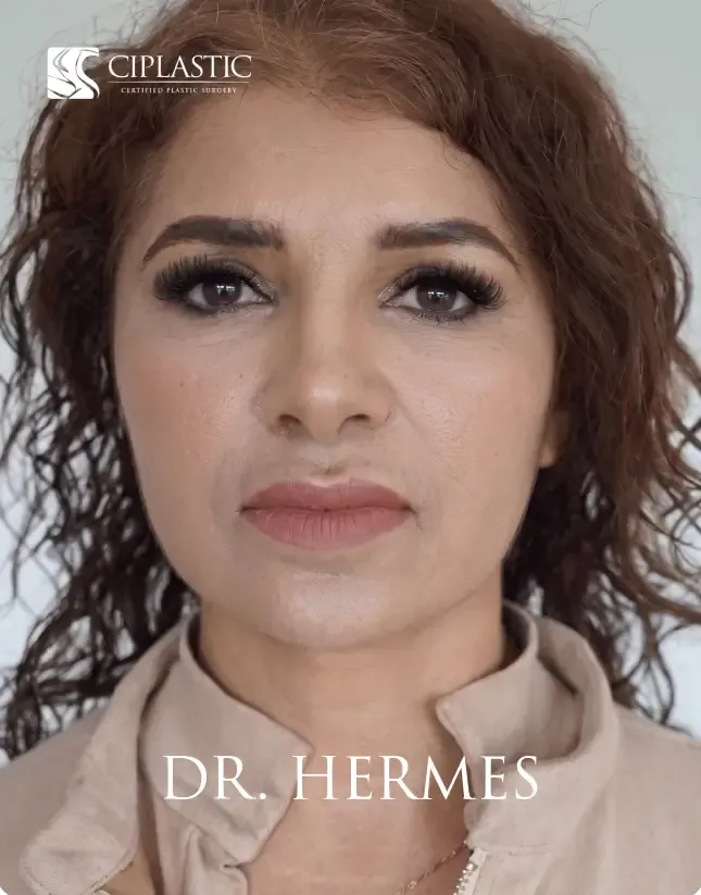 Ciplastic plastic surgery results