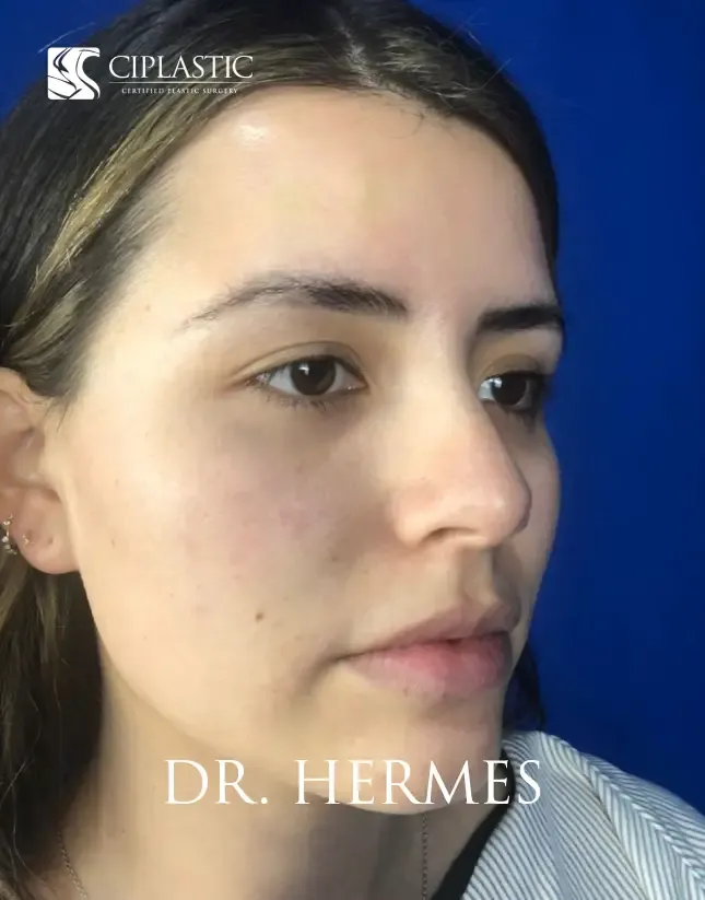 Ciplastic plastic surgery results