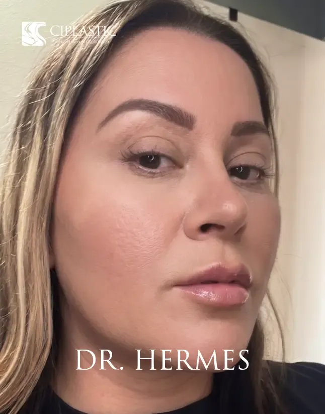 Ciplastic plastic surgery results