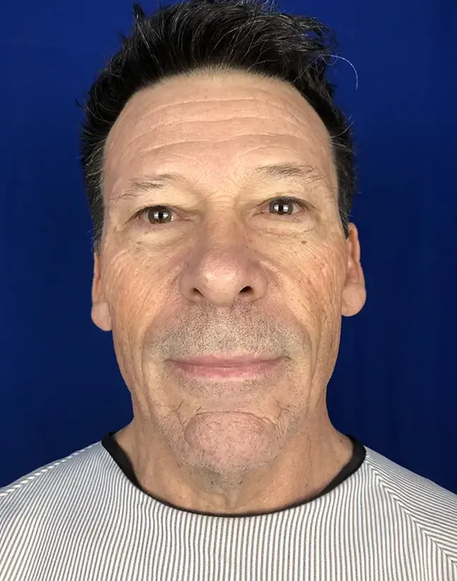 Ciplastic plastic surgery results