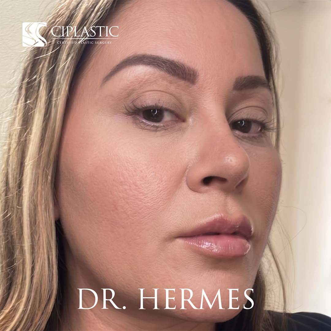 Ciplastic plastic surgery results