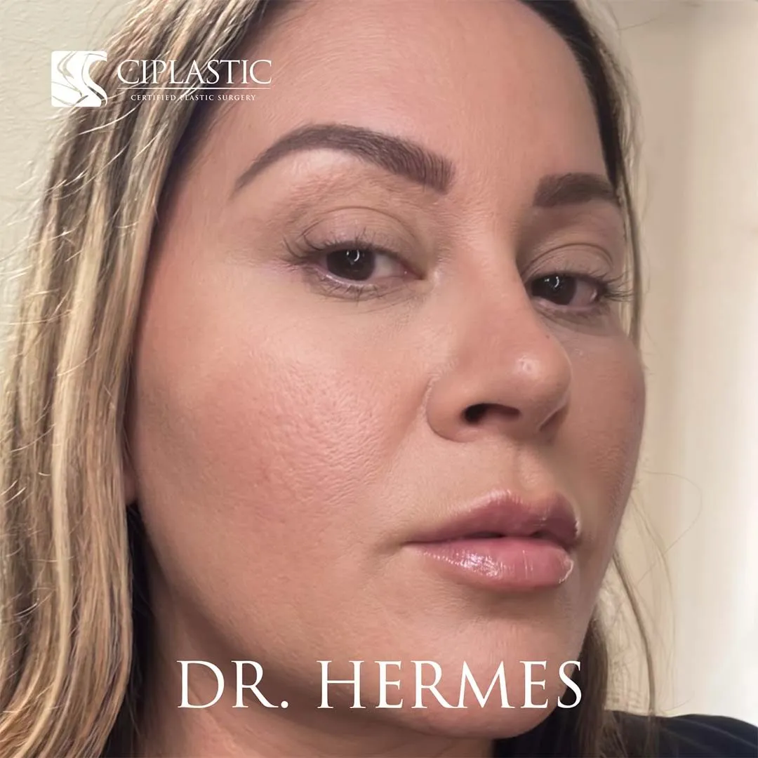 Ciplastic plastic surgery results
