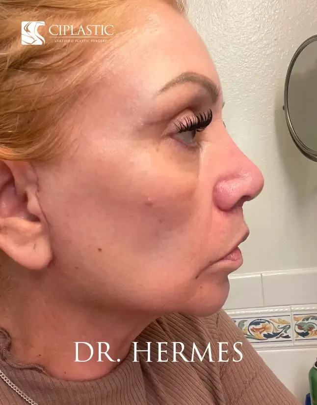 Ciplastic plastic surgery results
