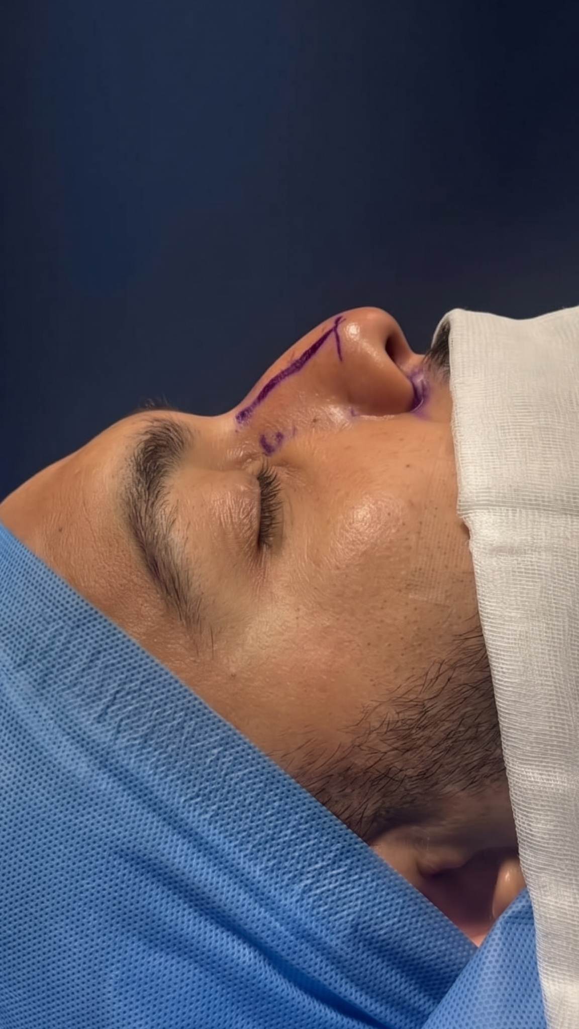 Ciplastic plastic surgery results
