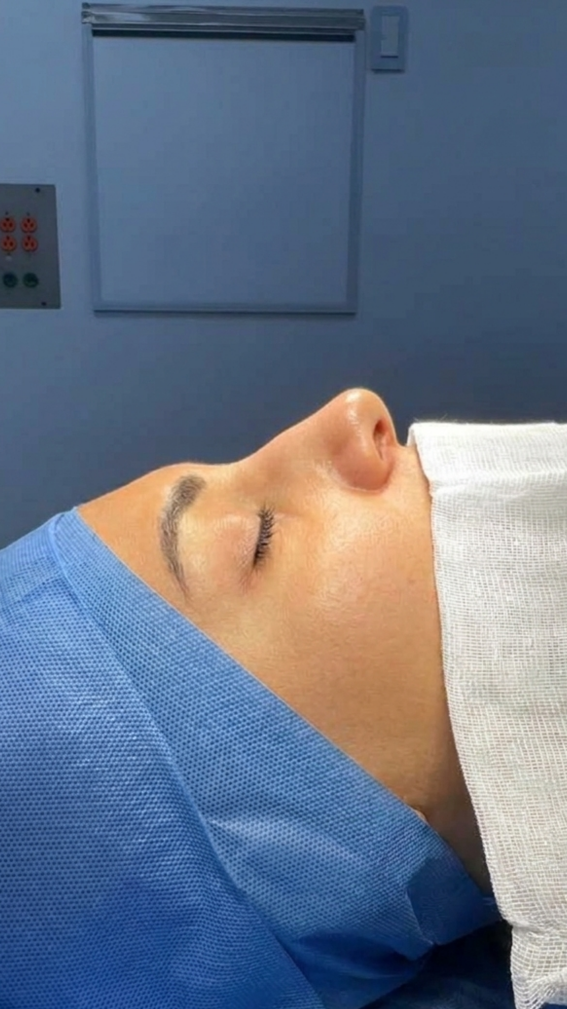 Ciplastic plastic surgery results