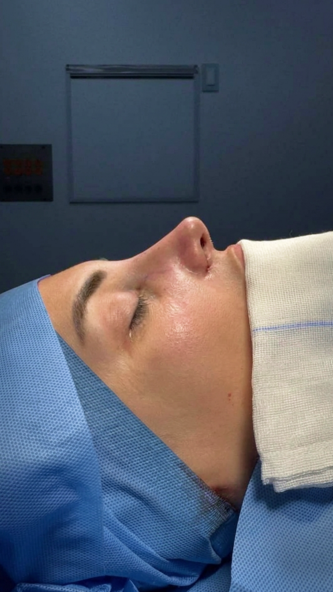 Ciplastic plastic surgery results