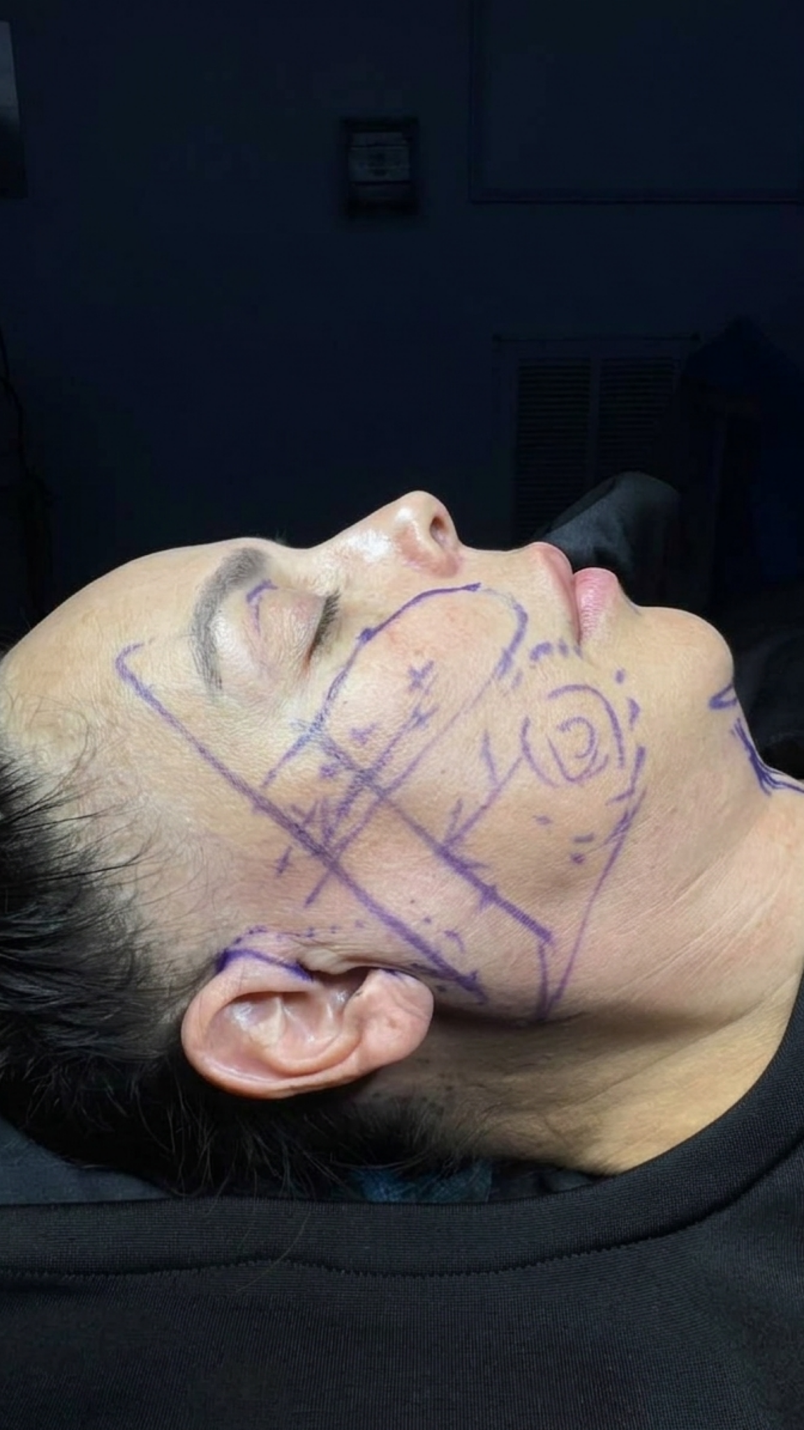 Ciplastic plastic surgery results