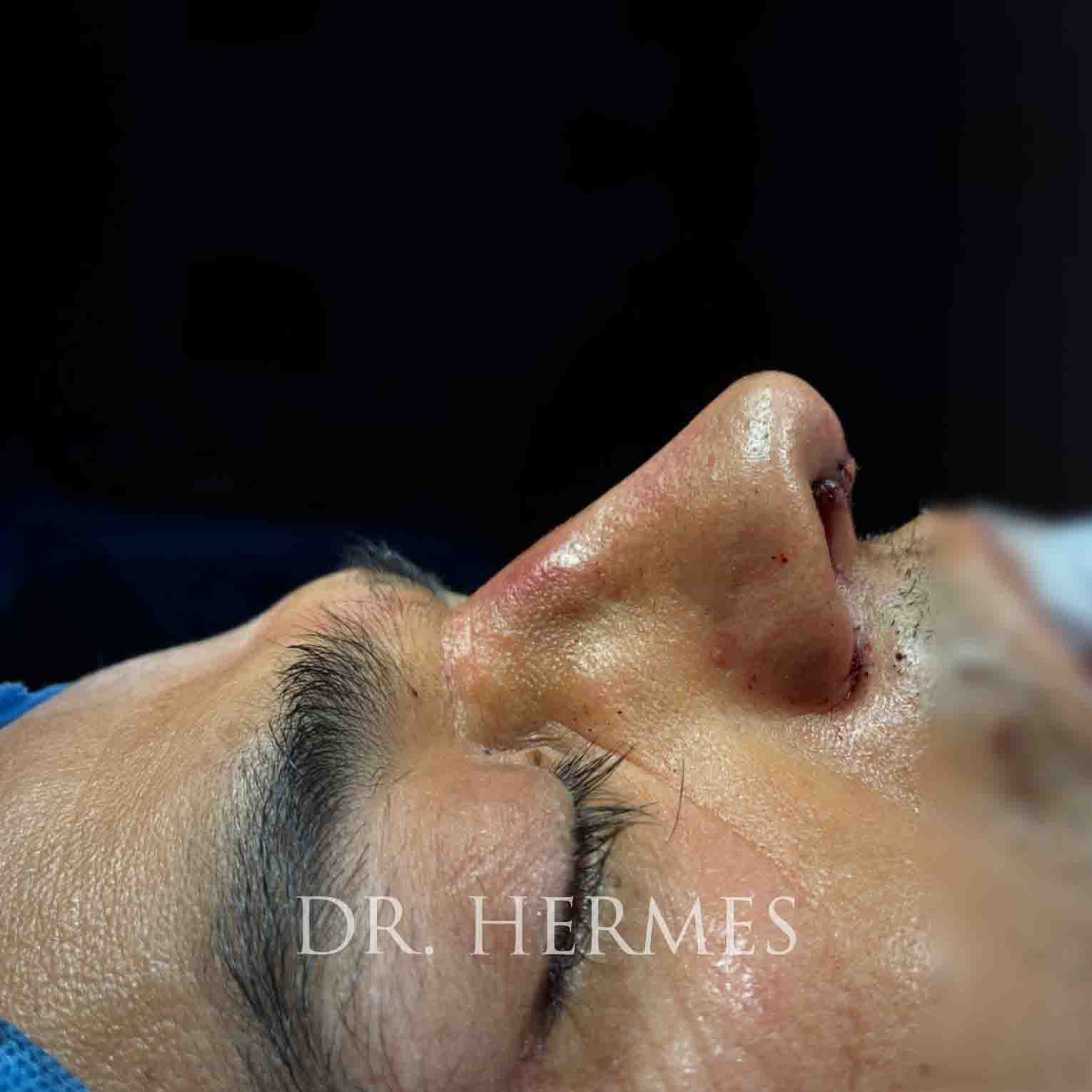 Ciplastic plastic surgery results