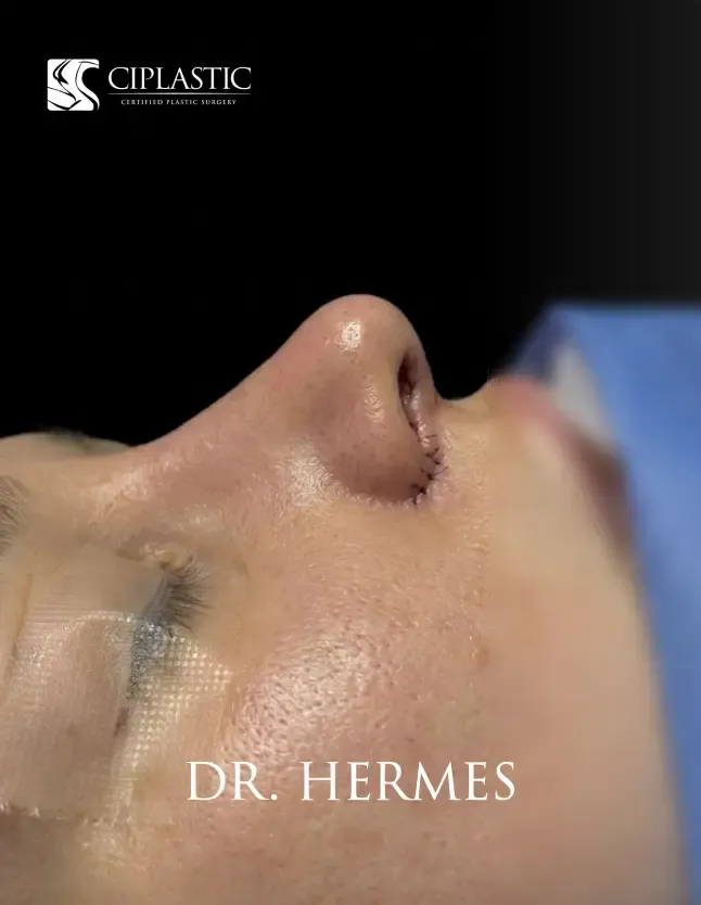 Ciplastic plastic surgery results