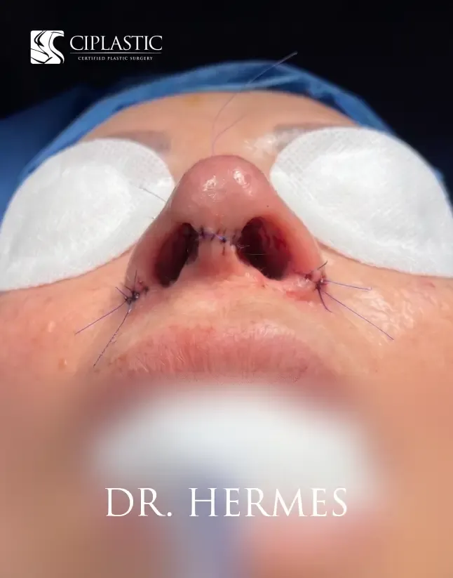 Ciplastic plastic surgery results