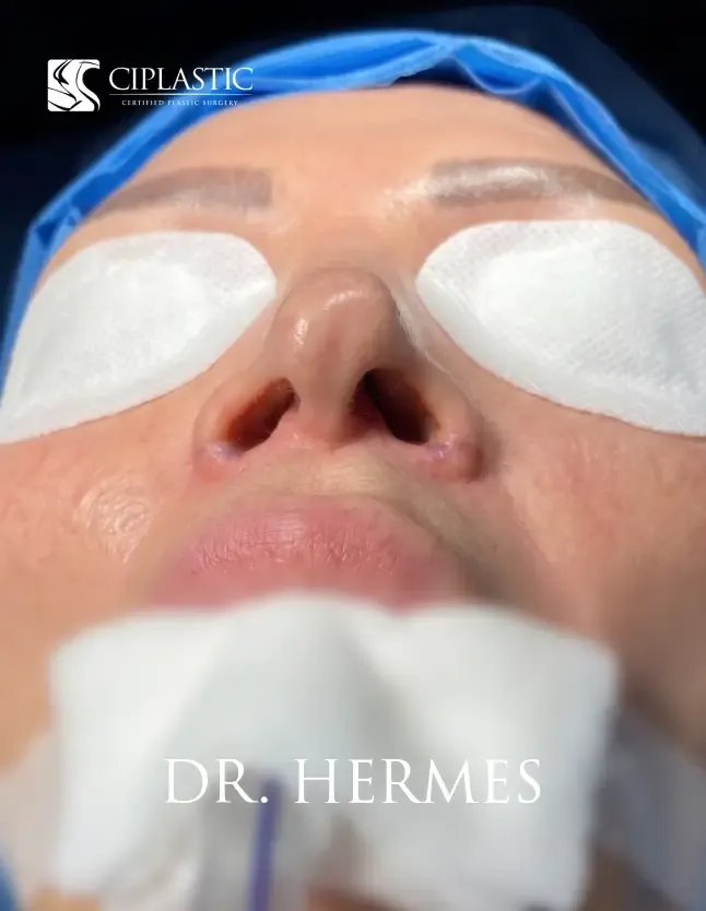 Ciplastic plastic surgery results