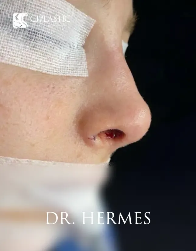 Ciplastic plastic surgery results