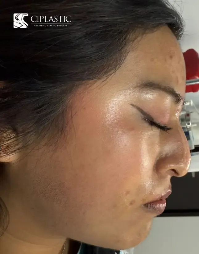 Ciplastic plastic surgery results