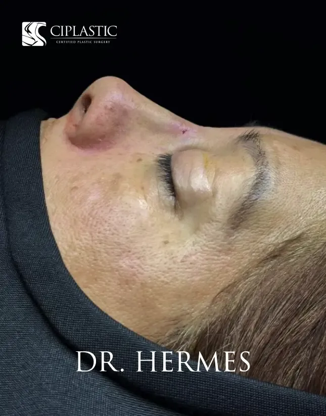 Ciplastic plastic surgery results