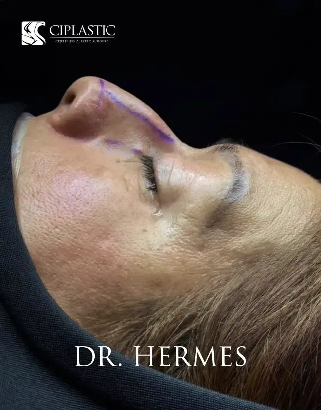 Ciplastic plastic surgery results
