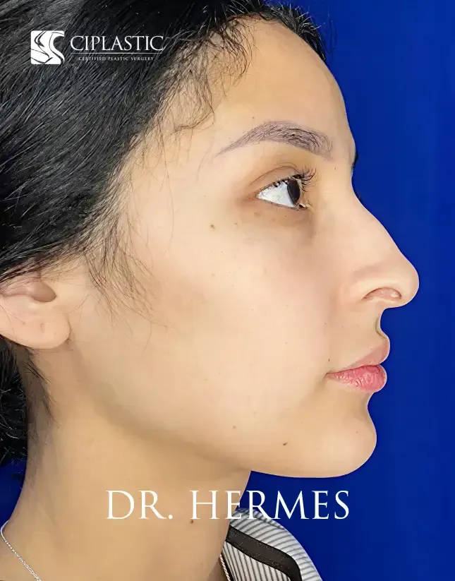 Ciplastic plastic surgery results