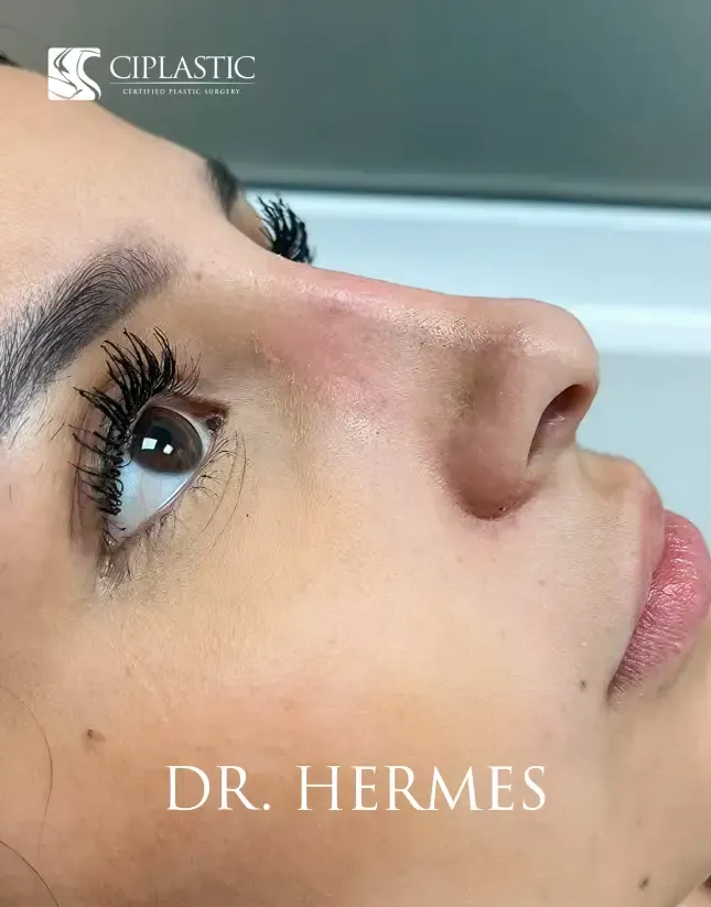 Ciplastic plastic surgery results