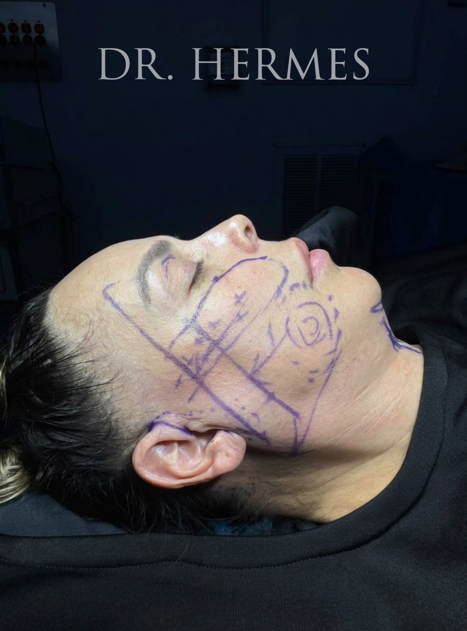 Ciplastic plastic surgery results
