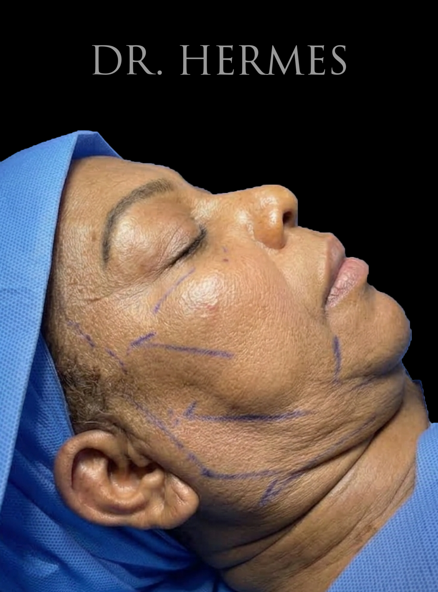 Ciplastic plastic surgery results