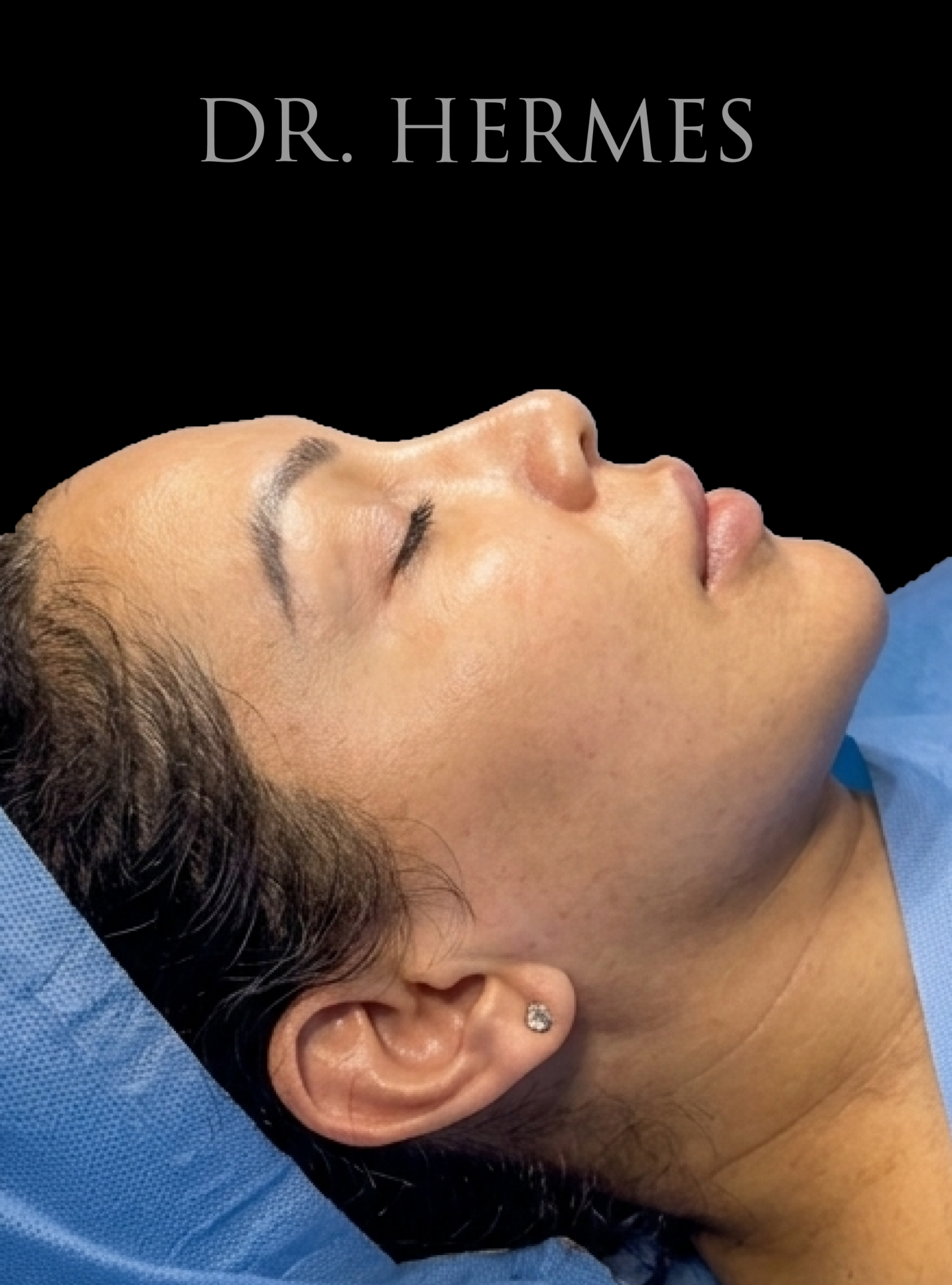 Ciplastic plastic surgery results