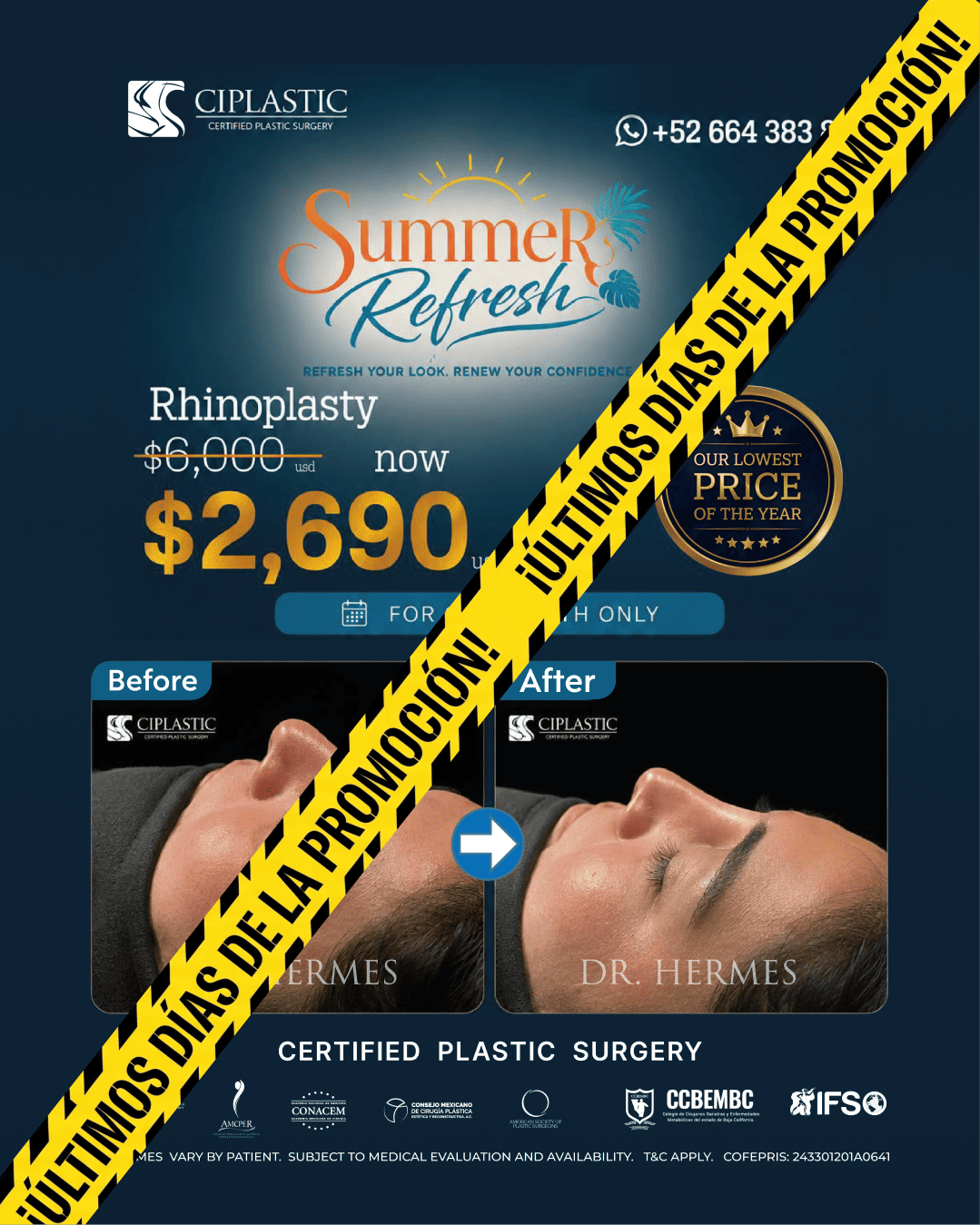 Ciplastic plastic surgery results