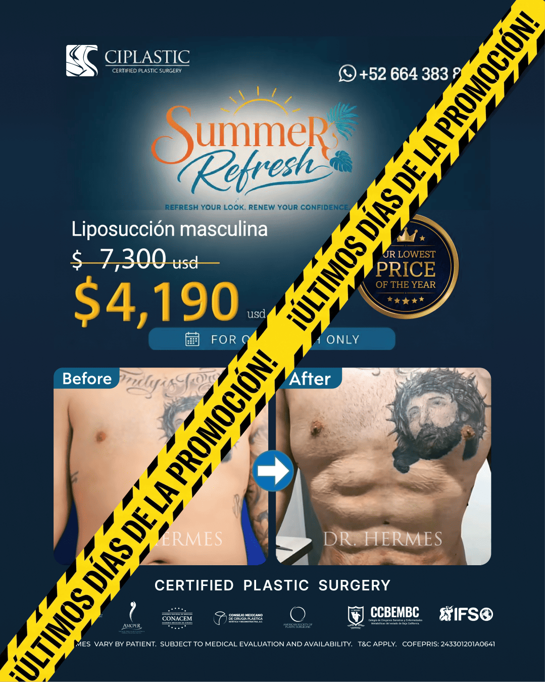 Ciplastic plastic surgery results