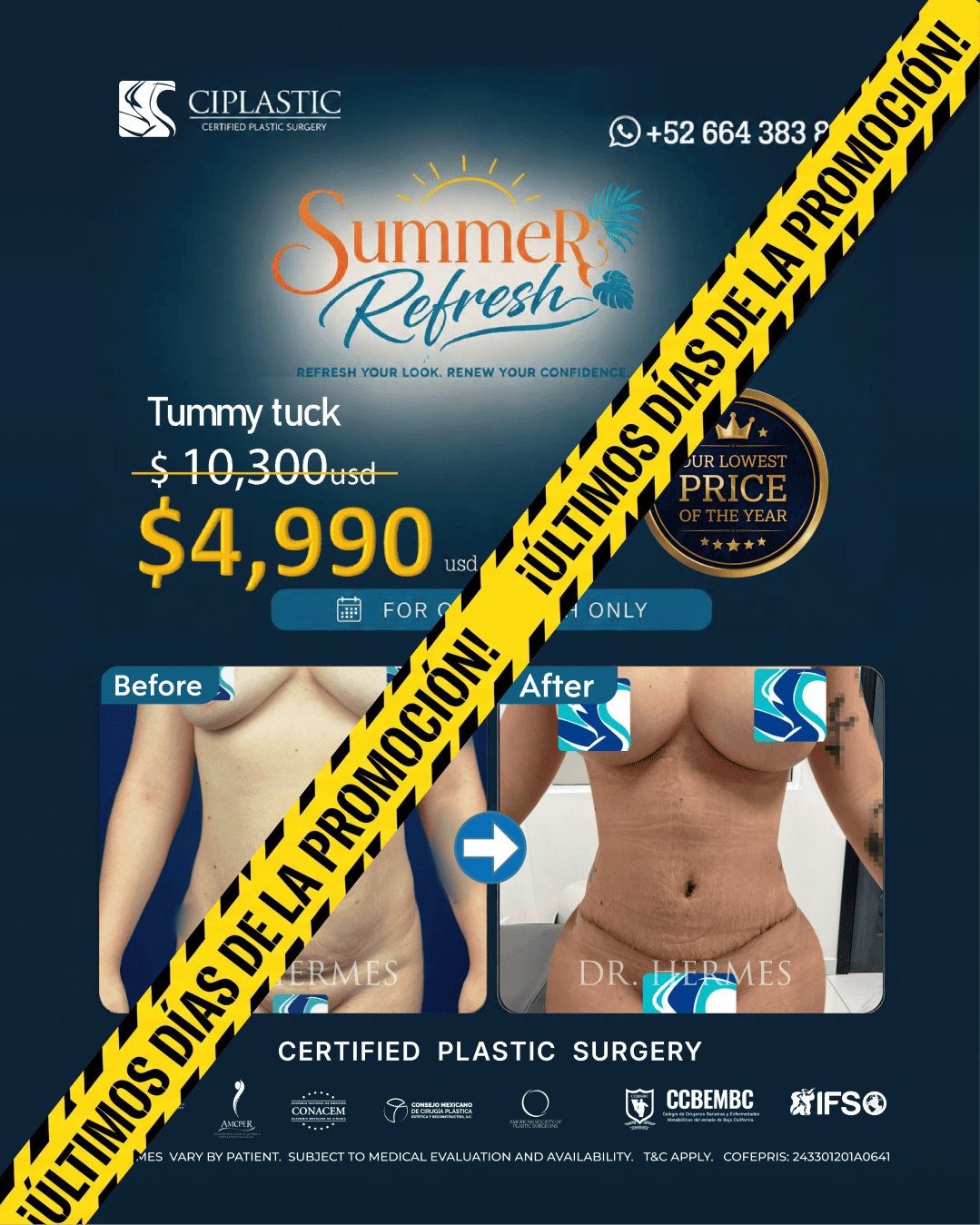 Ciplastic plastic surgery results