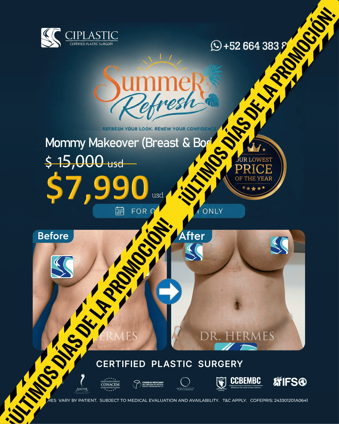 Ciplastic plastic surgery results