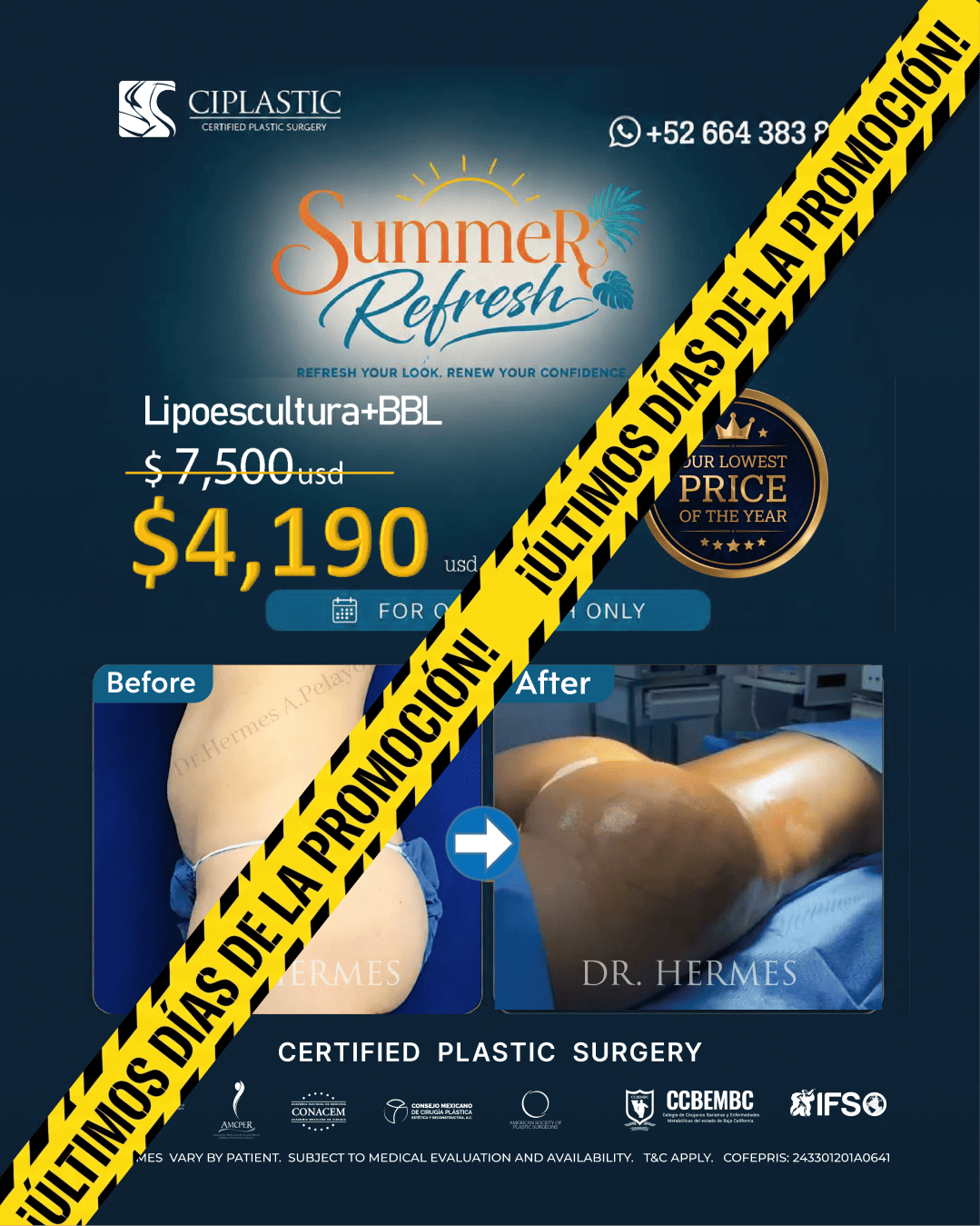 Ciplastic plastic surgery results