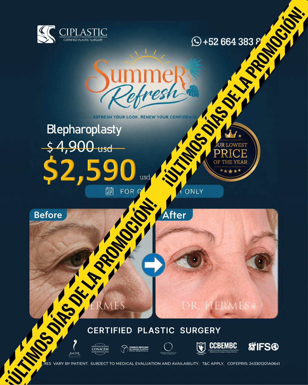 Ciplastic plastic surgery results