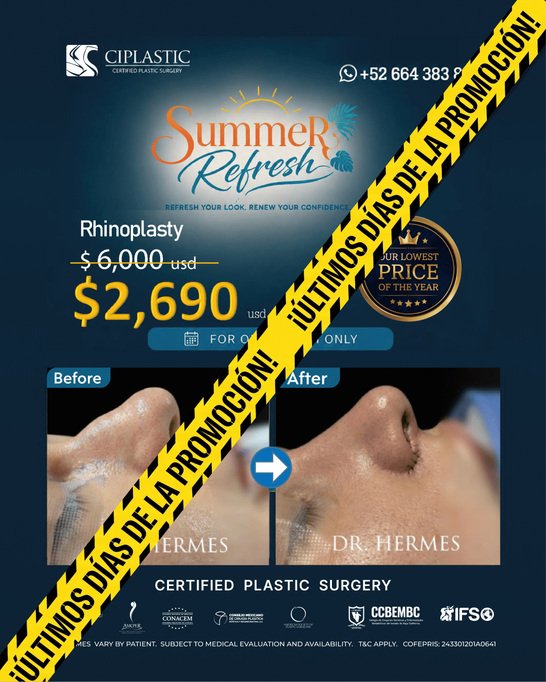 Ciplastic plastic surgery results
