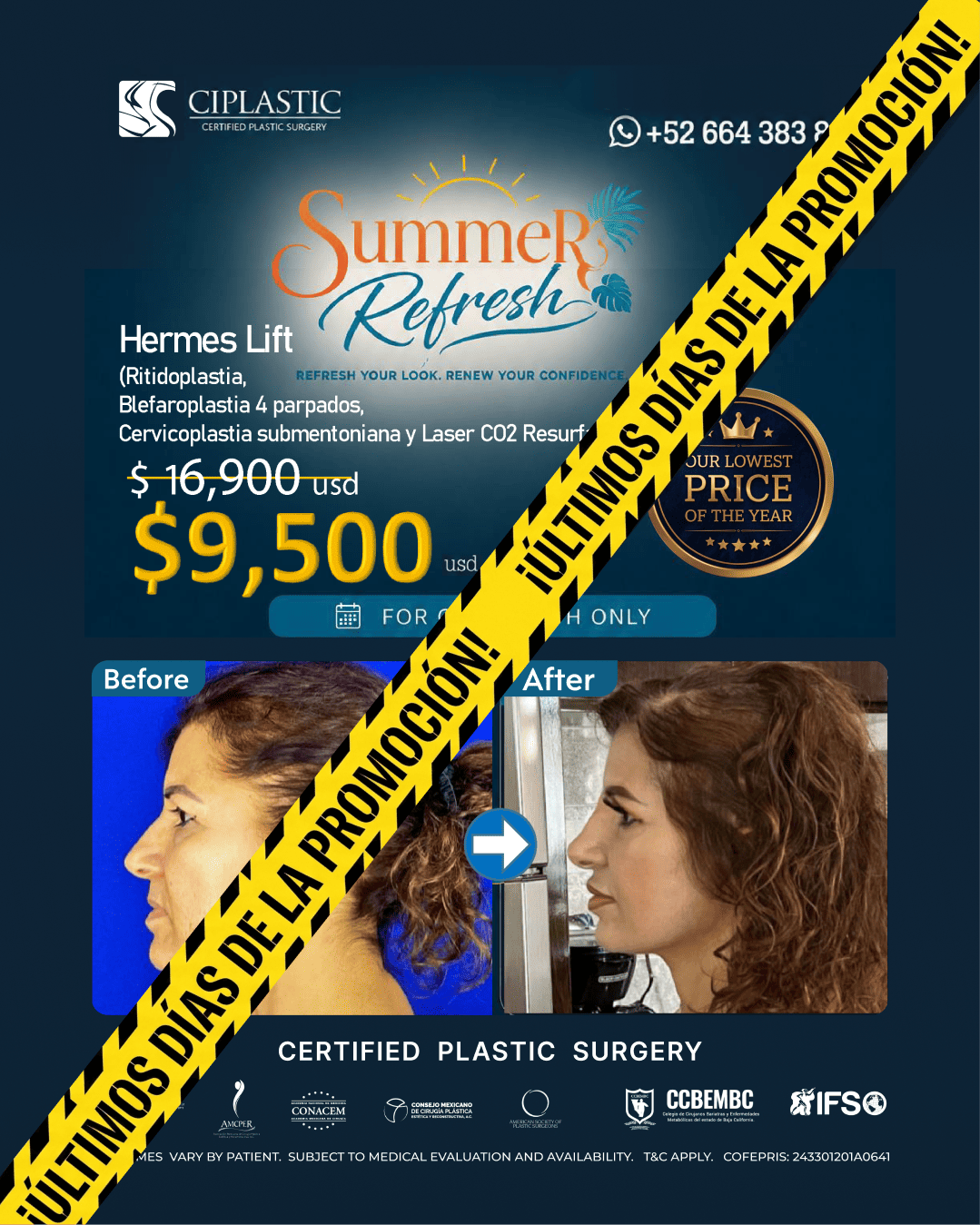 Ciplastic plastic surgery results