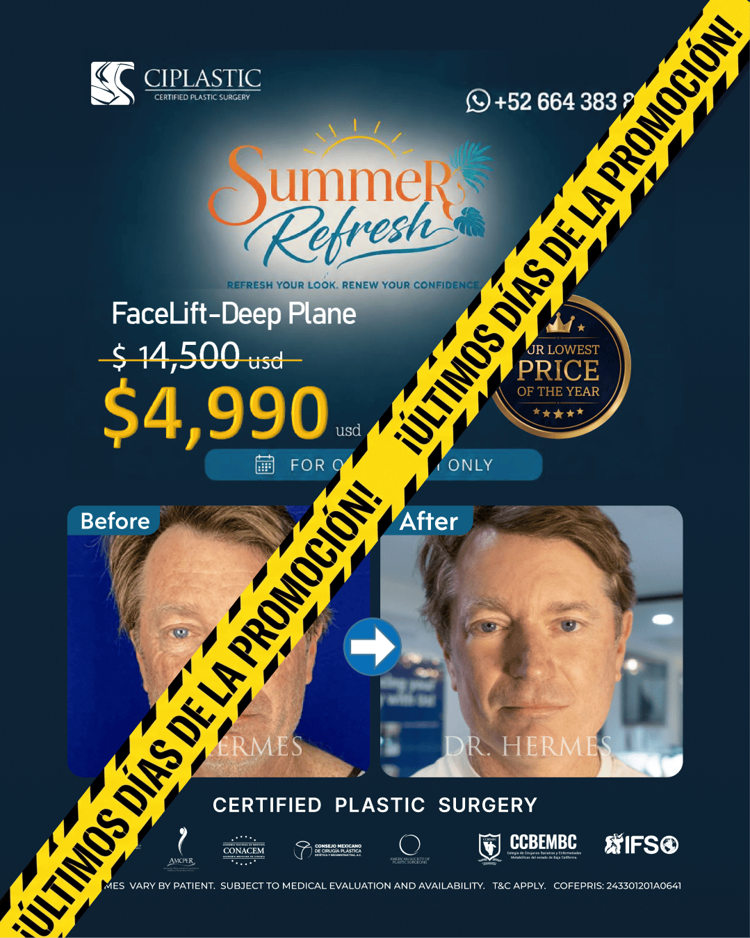 Ciplastic plastic surgery results