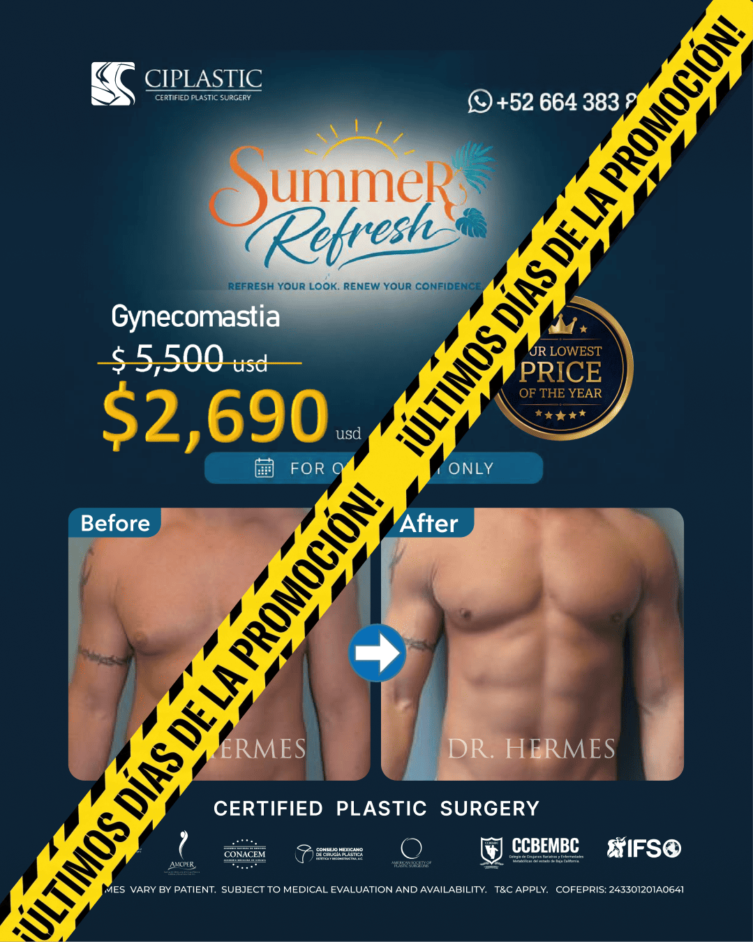 Ciplastic plastic surgery results