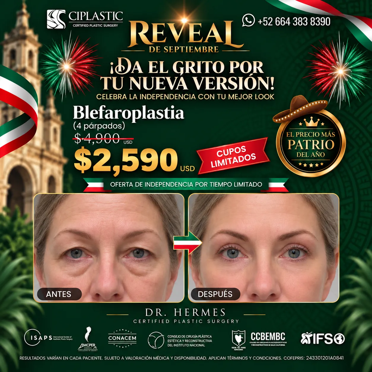 Ciplastic plastic surgery results
