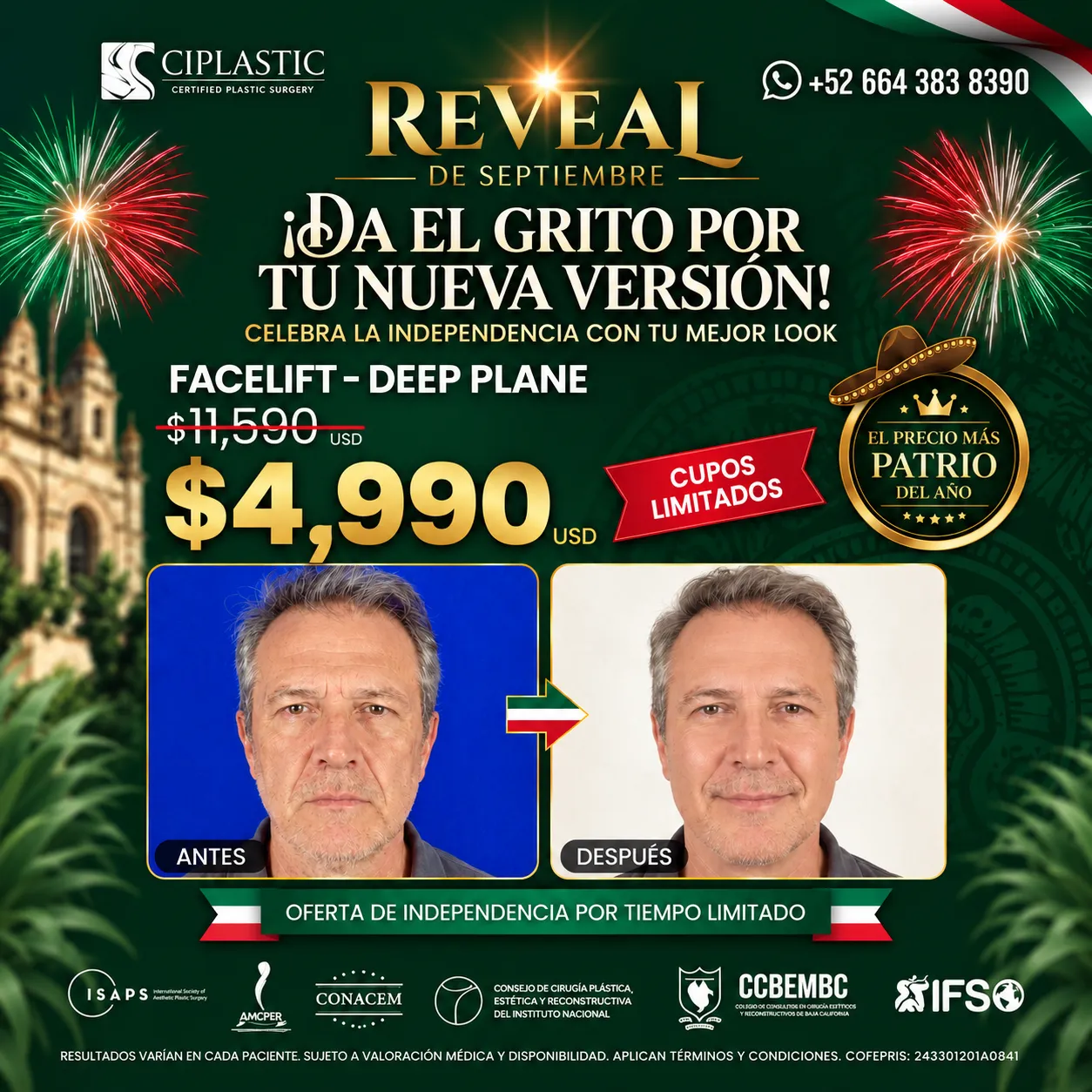 Ciplastic plastic surgery results