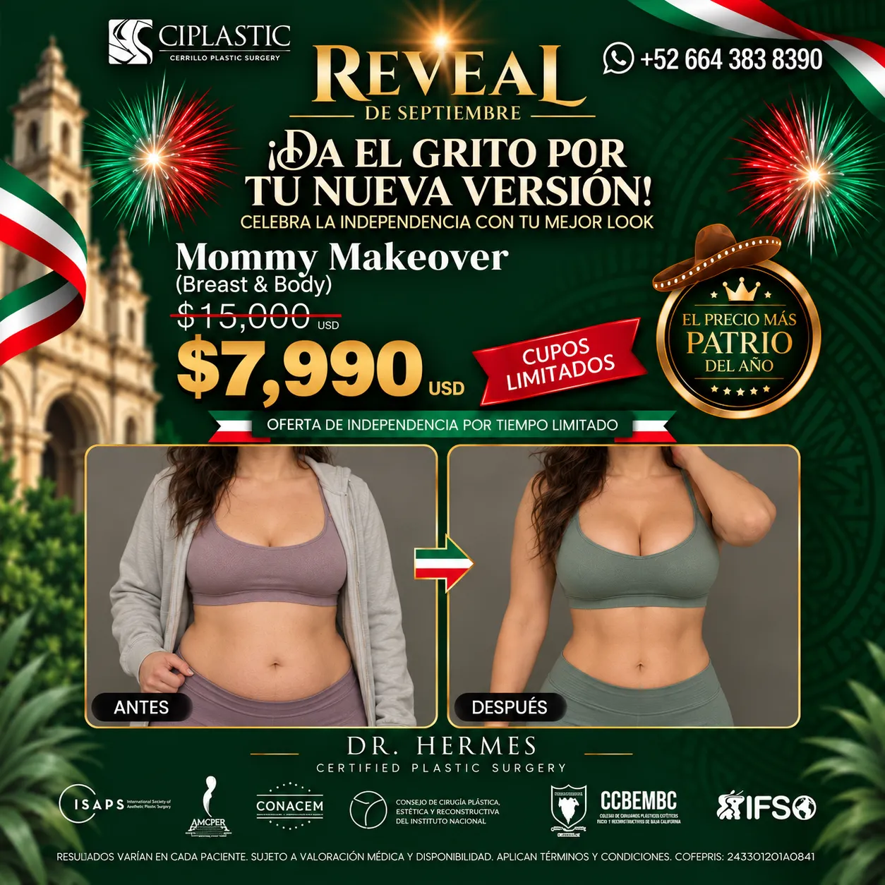 Ciplastic plastic surgery results