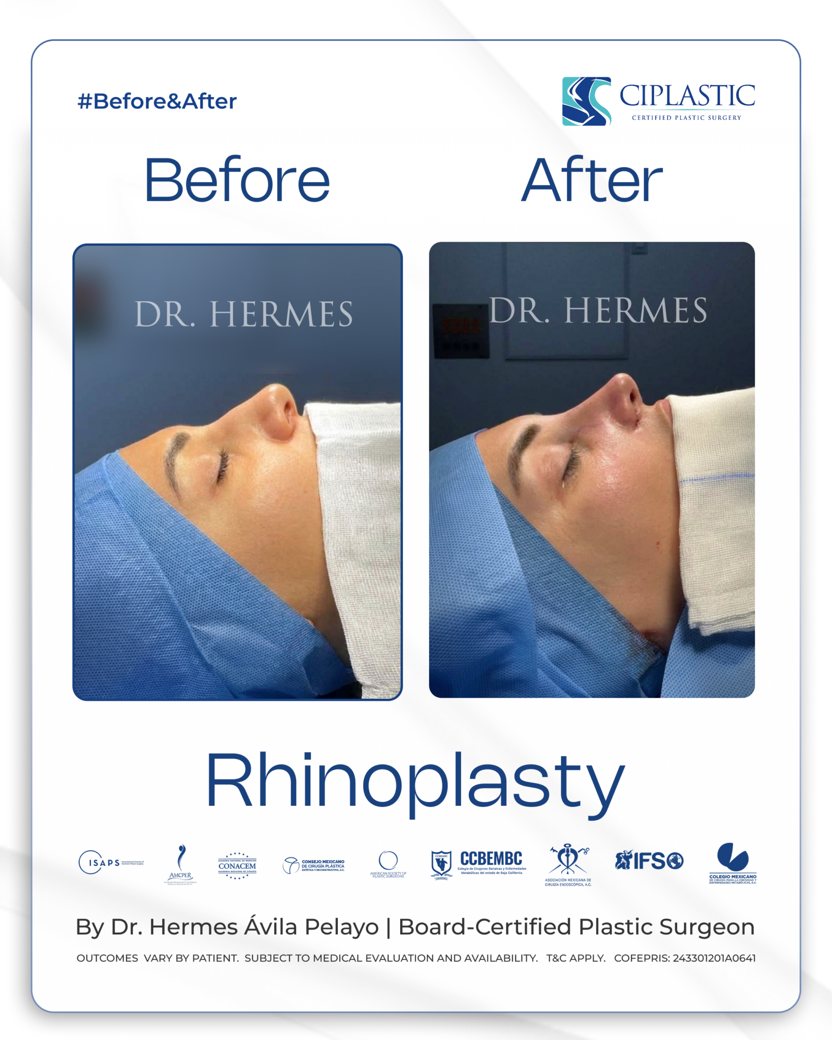 Ciplastic plastic surgery results