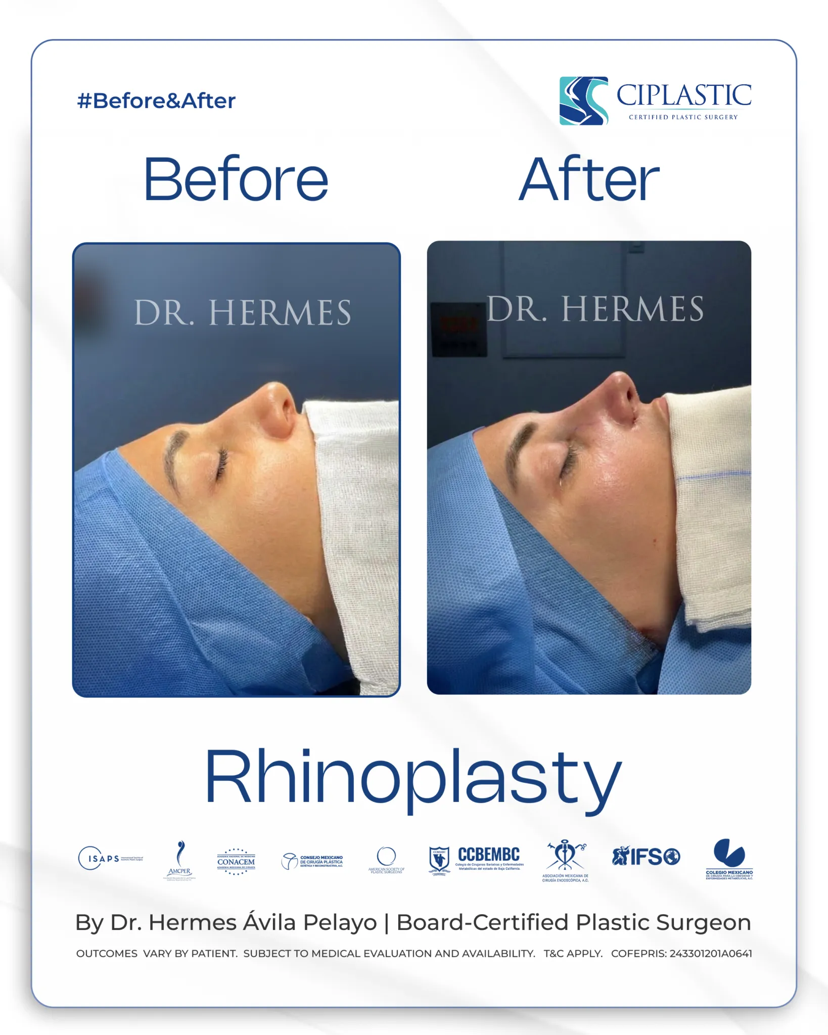 Ciplastic plastic surgery results