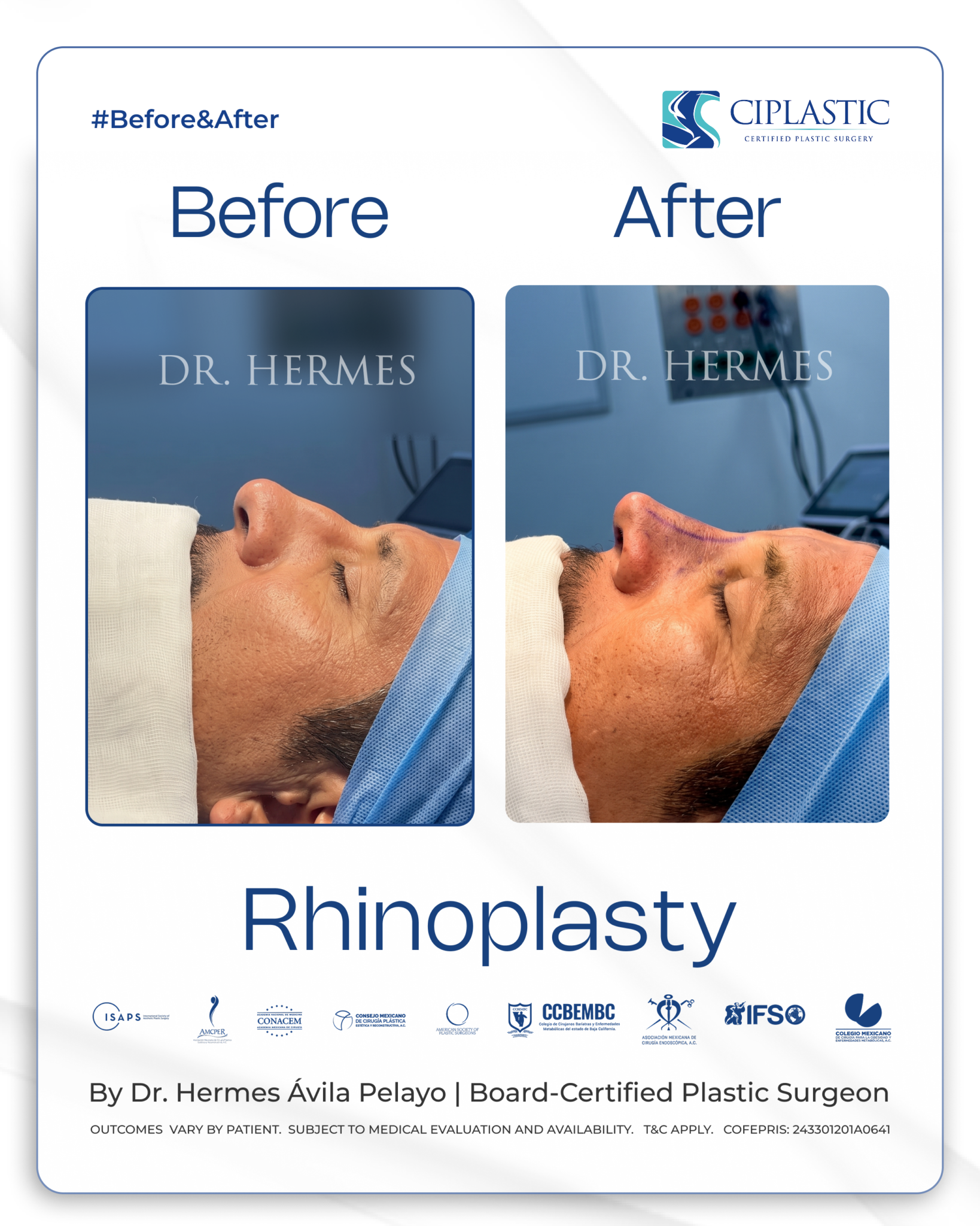 Ciplastic plastic surgery results