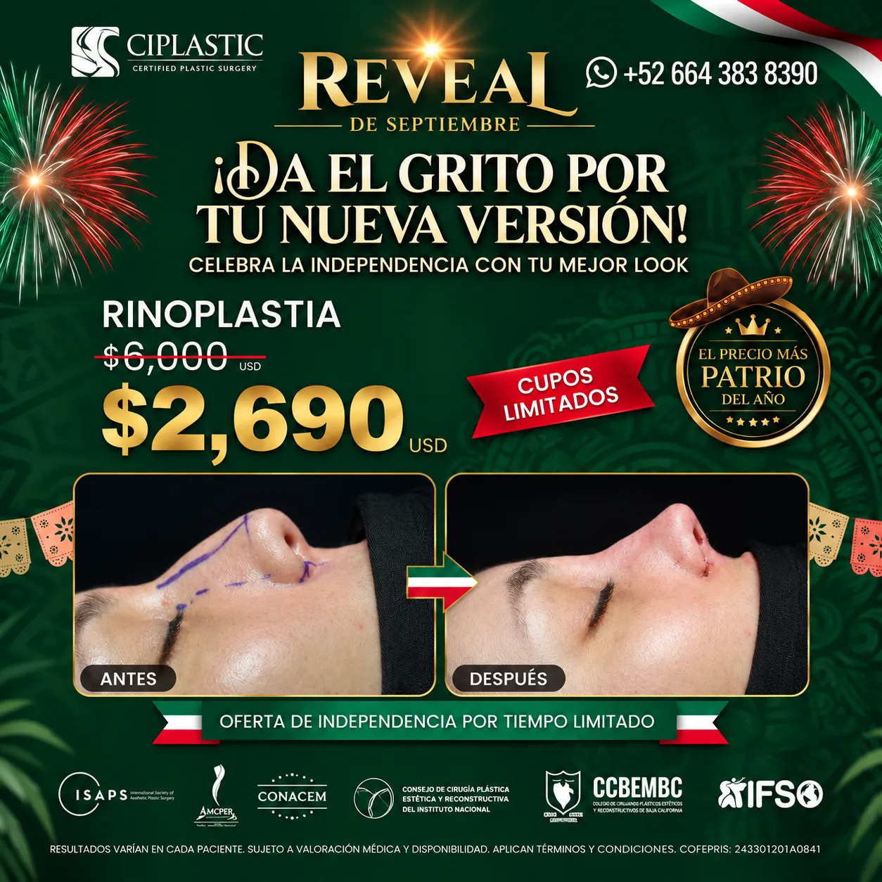 Ciplastic plastic surgery results