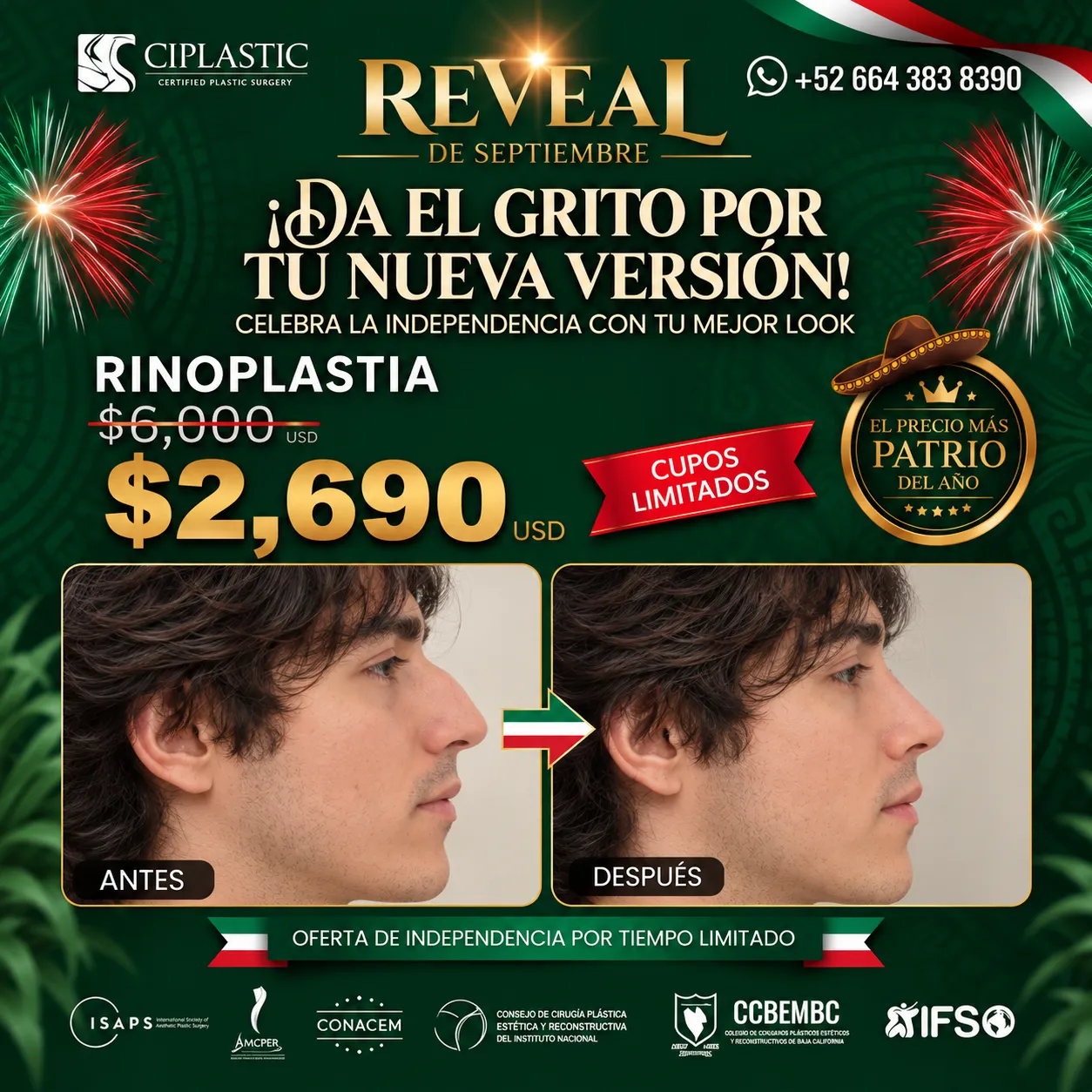 Ciplastic plastic surgery results