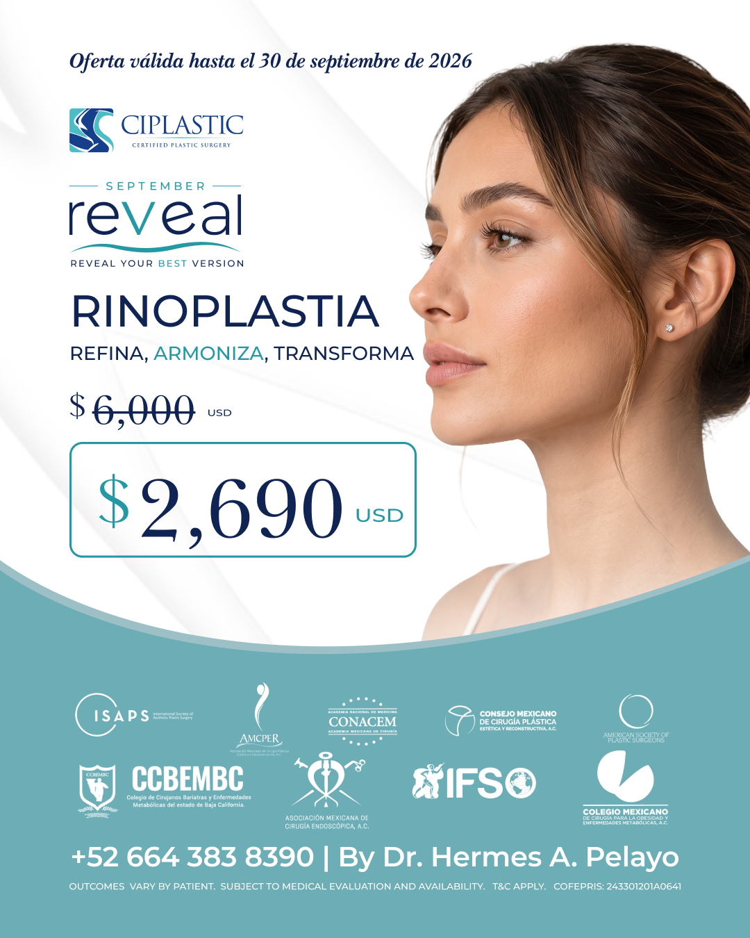 Ciplastic plastic surgery results